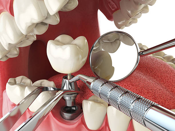 Best Urgent Care for Lost Fillings or Crowns in Mesilla, NM